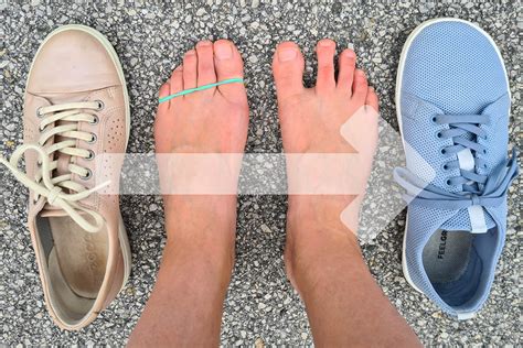 why barefoot shoes are bad